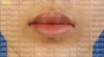 lip