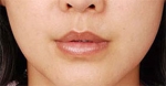 lip