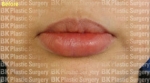 lip