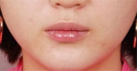 lip