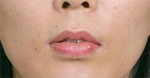 lip