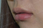 lip