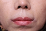 lip