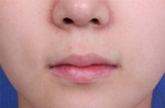 lip