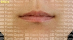 lip