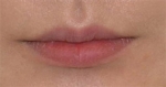 lip