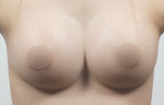 breast