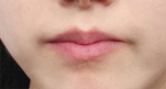 lip