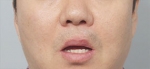 lip