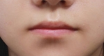 lip