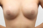 breast