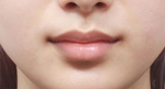 lip