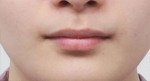 lip