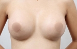 breast