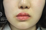 lip