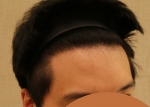 hairline