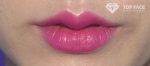 lip