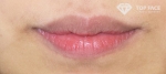 lip