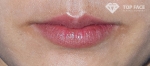 lip