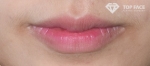 lip