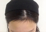 hairline