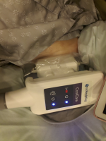 Coolsculpting (zeltiq) procedure at wannabe clinic