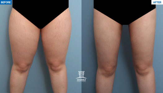 Clinic — MARBLE Plastic Surgery