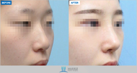 Clinic — MARBLE Plastic Surgery