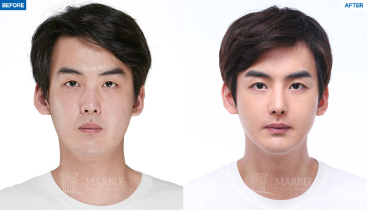 Clinic — MARBLE Plastic Surgery