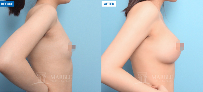 Clinic — MARBLE Plastic Surgery