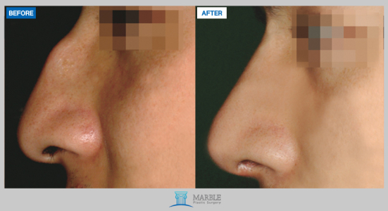 Clinic — MARBLE Plastic Surgery