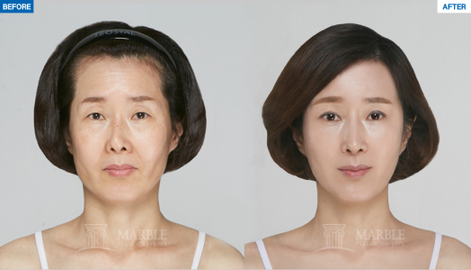 Clinic — MARBLE Plastic Surgery