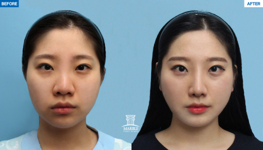 Clinic — MARBLE Plastic Surgery
