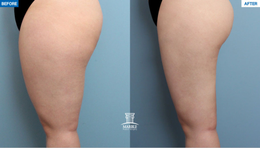 Clinic — MARBLE Plastic Surgery