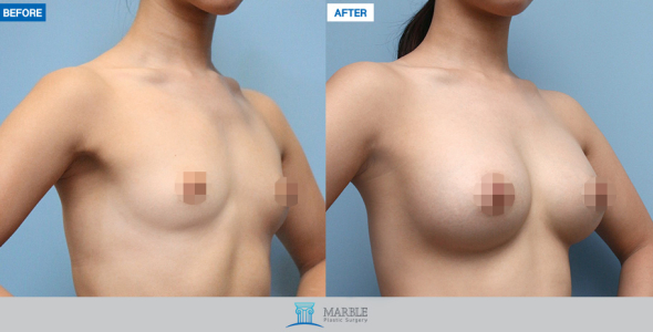 Clinic — MARBLE Plastic Surgery