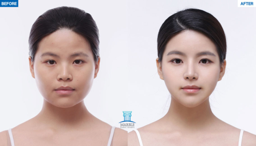 Clinic — MARBLE Plastic Surgery
