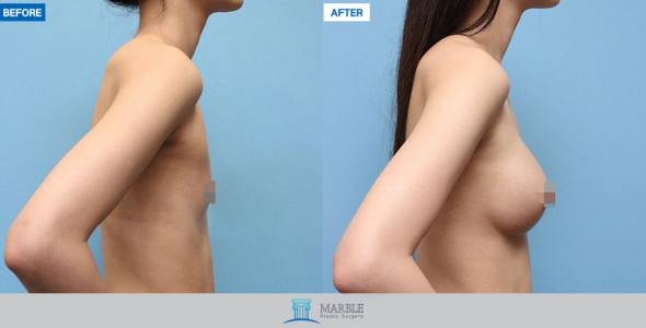 Clinic — MARBLE Plastic Surgery
