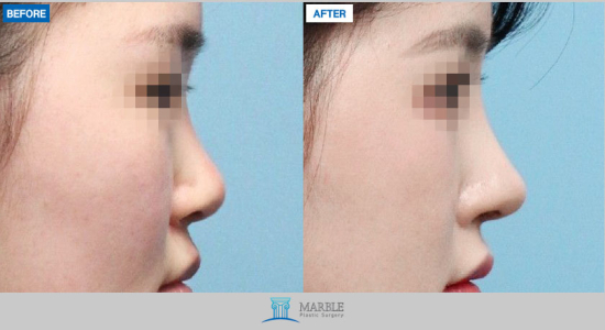Clinic — MARBLE Plastic Surgery