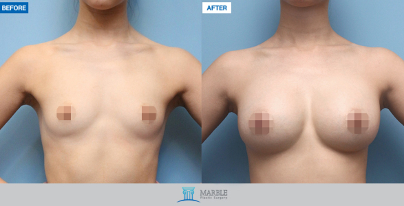 Clinic — MARBLE Plastic Surgery