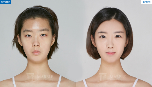 Clinic — MARBLE Plastic Surgery