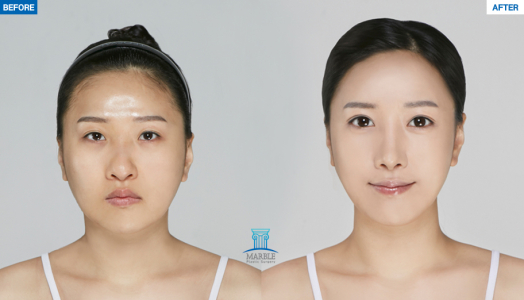 Clinic — MARBLE Plastic Surgery