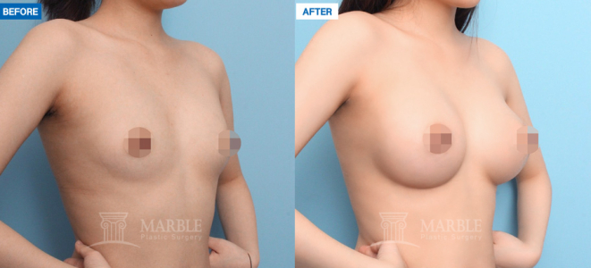 Clinic — MARBLE Plastic Surgery