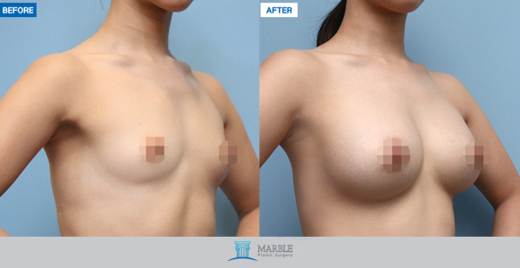 Clinic — MARBLE Plastic Surgery