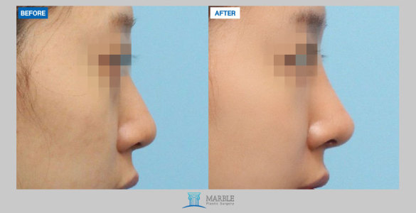 Clinic — MARBLE Plastic Surgery
