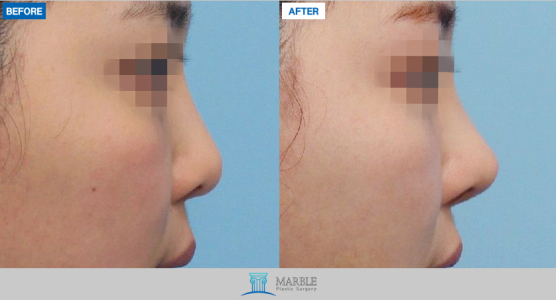 Clinic — MARBLE Plastic Surgery