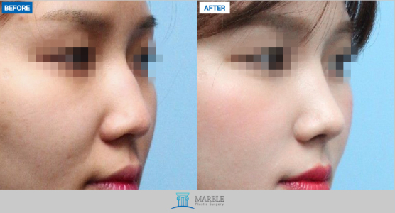 Clinic — MARBLE Plastic Surgery