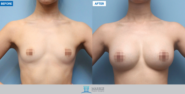 Clinic — MARBLE Plastic Surgery