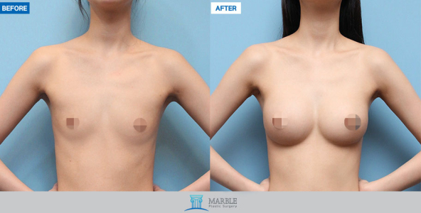 Clinic — MARBLE Plastic Surgery