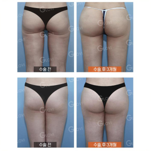 Clinic — Glovi Plastic Surgery