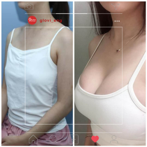 Clinic — Glovi Plastic Surgery